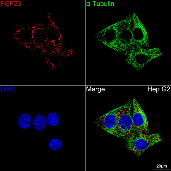 FGF23 Antibody in Immunocytochemistry (ICC/IF)