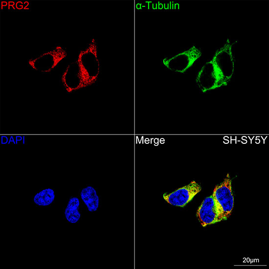 PRG2 Antibody in Immunocytochemistry (ICC/IF)