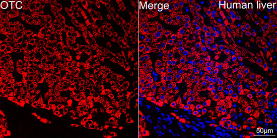 OTC Antibody in Immunohistochemistry (Paraffin) (IHC (P))