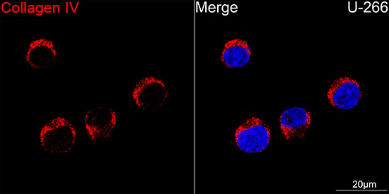 Collagen IV Antibody in Immunocytochemistry (ICC/IF)