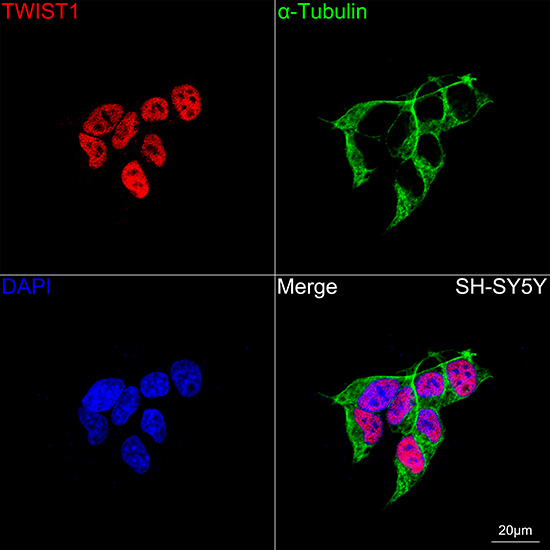 TWIST1 Antibody in Immunocytochemistry (ICC/IF)
