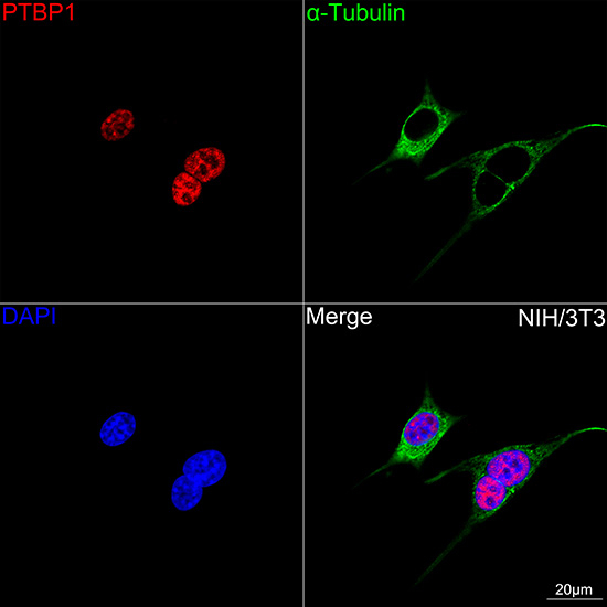 PTBP1 Antibody in Immunocytochemistry (ICC/IF)
