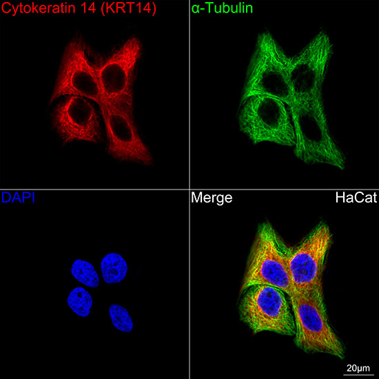 Cytokeratin 14 Antibody in Immunocytochemistry (ICC/IF)