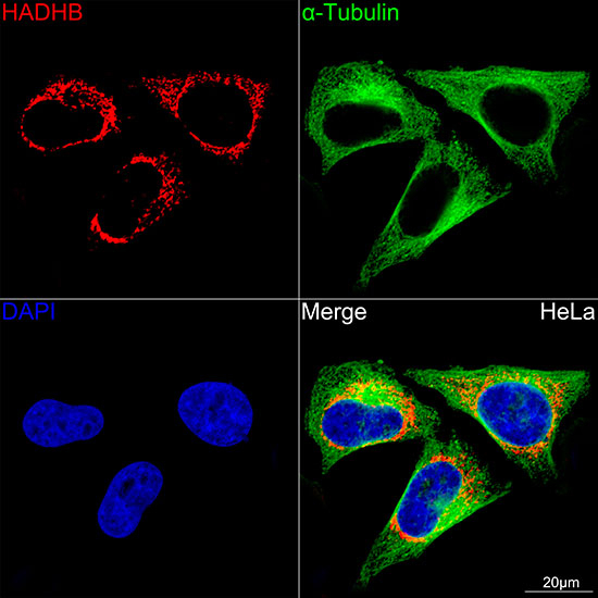 HADHB Antibody in Immunocytochemistry (ICC/IF)