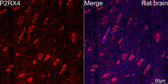P2X4 Antibody in Immunohistochemistry (Paraffin) (IHC (P))
