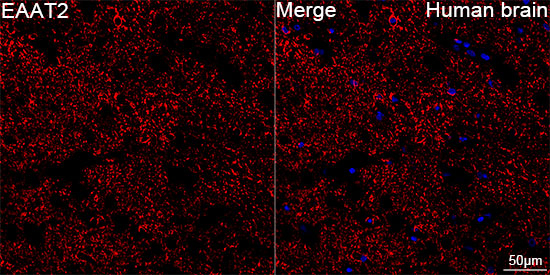 GLT-1 Antibody in Immunohistochemistry (Paraffin) (IHC (P))