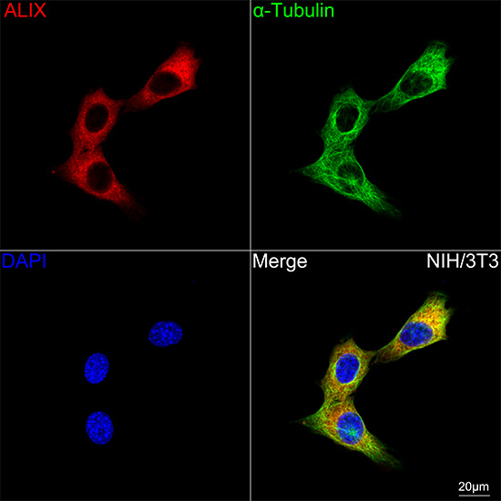 Alix Antibody in Immunocytochemistry (ICC/IF)