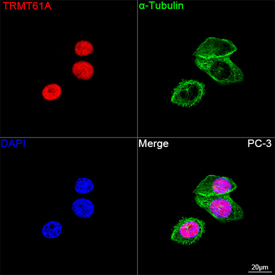 TRMT61A Antibody in Immunocytochemistry (ICC/IF)