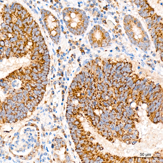 Cyclophilin F Antibody in Immunohistochemistry (Paraffin) (IHC (P))