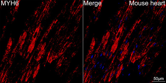 MYH6 Antibody in Immunohistochemistry (Paraffin) (IHC (P))