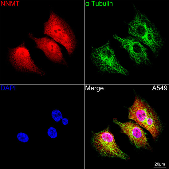 NNMT Antibody in Immunocytochemistry (ICC/IF)