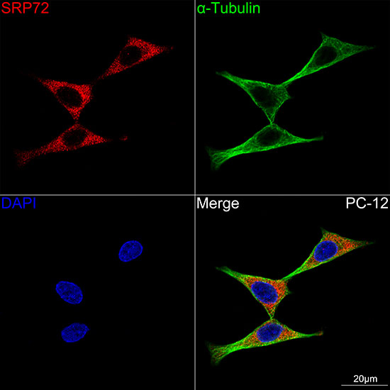 SRP72 Antibody in Immunocytochemistry (ICC/IF)