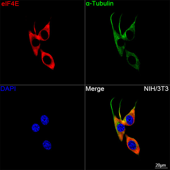 eIF4E Antibody in Immunocytochemistry (ICC/IF)