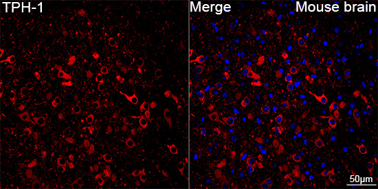 TPH1 Antibody in Immunohistochemistry (Paraffin) (IHC (P))