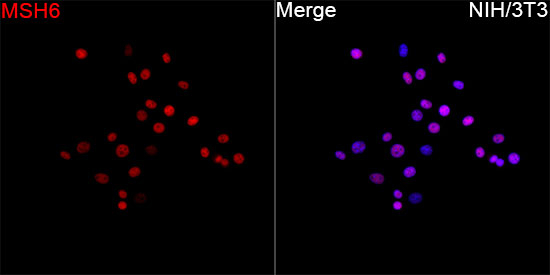 MSH6 Antibody in Immunocytochemistry (ICC/IF)
