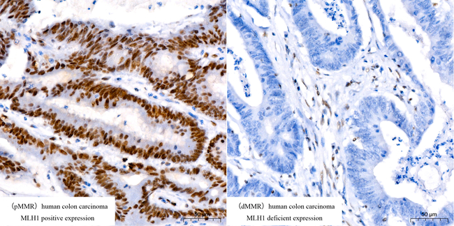 MLH1 Antibody in Immunohistochemistry (Paraffin) (IHC (P))