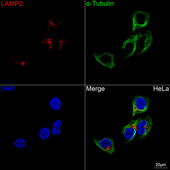 LAMP2 Antibody in Immunocytochemistry (ICC/IF)