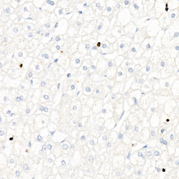 T-bet Antibody in Immunohistochemistry (Paraffin) (IHC (P))