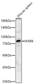 RXRB Antibody in Western Blot (WB)