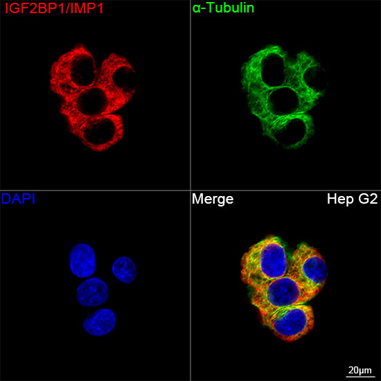 IGF2BP1 Antibody in Immunocytochemistry (ICC/IF)
