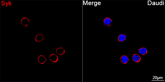 Syk Antibody in Immunocytochemistry (ICC/IF)