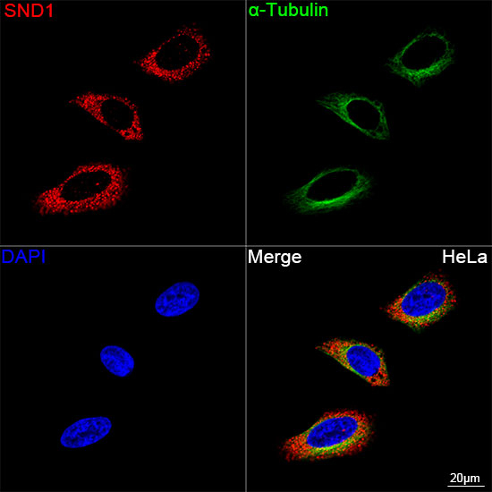 SND1 Antibody in Immunocytochemistry (ICC/IF)