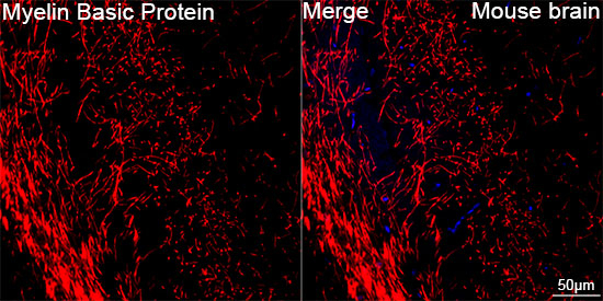 MBP Antibody in Immunohistochemistry (Paraffin) (IHC (P))