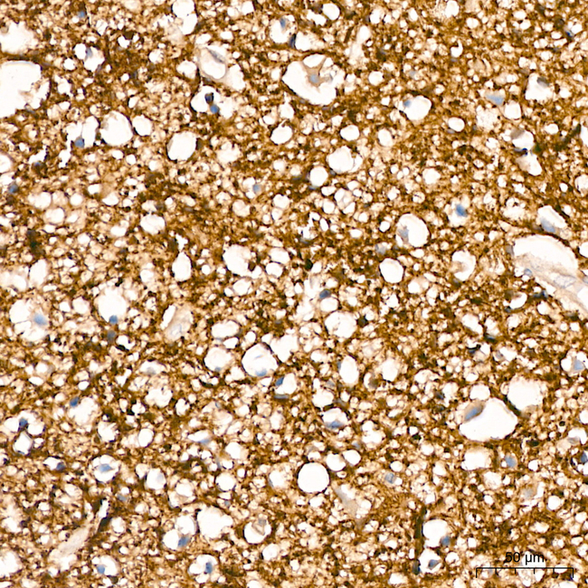 SIRT2 Antibody in Immunohistochemistry (Paraffin) (IHC (P))