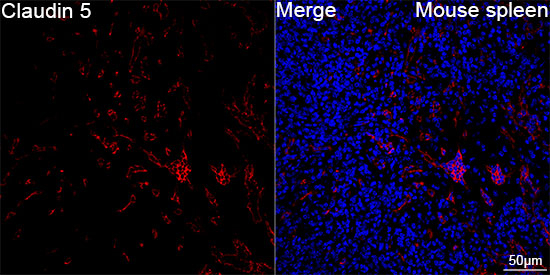 Claudin 5 Antibody in Immunohistochemistry (Paraffin) (IHC (P))