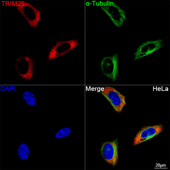 TRIM25 Antibody in Immunocytochemistry (ICC/IF)