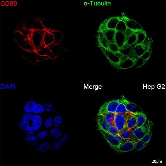 CD99 Antibody in Immunocytochemistry (ICC/IF)