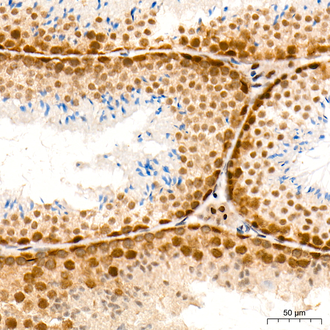 POLR2L Antibody in Immunohistochemistry (Paraffin) (IHC (P))
