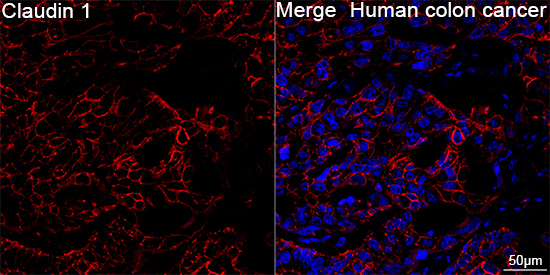Claudin 1 Antibody in Immunohistochemistry (Paraffin) (IHC (P))