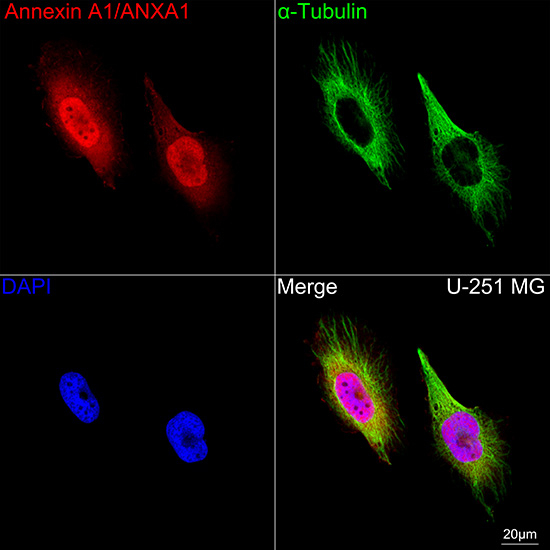 Annexin A1 Antibody in Immunocytochemistry (ICC/IF)