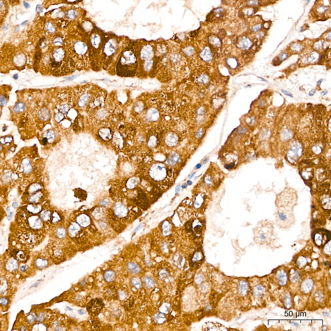 COX7A2L Antibody in Immunohistochemistry (Paraffin) (IHC (P))