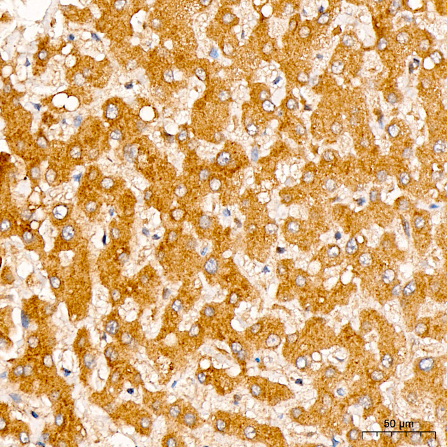 TFEB Antibody in Immunohistochemistry (Paraffin) (IHC (P))