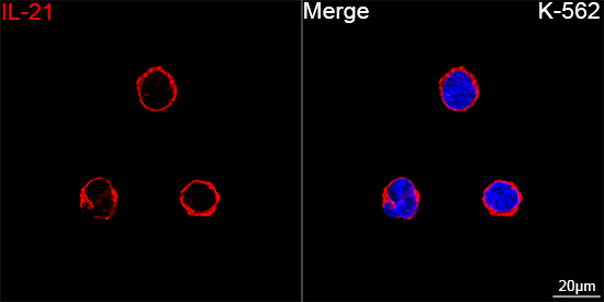 IL-21 Antibody in Immunocytochemistry (ICC/IF)