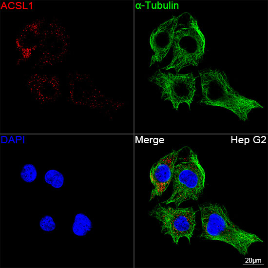 ACSL1 Antibody in Immunocytochemistry (ICC/IF)