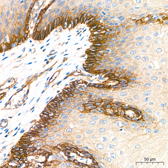 ITGA3 Antibody in Immunohistochemistry (Paraffin) (IHC (P))