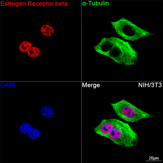 Estrogen Receptor beta Antibody in Immunocytochemistry (ICC/IF)
