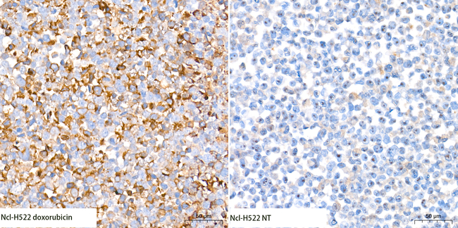DFNA5 Antibody in Immunocytochemistry (ICC/IF)