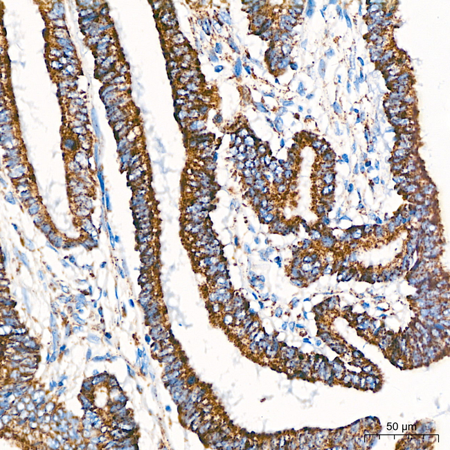 MRPL20 Antibody in Immunohistochemistry (Paraffin) (IHC (P))