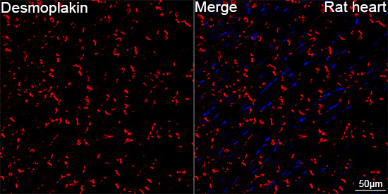 Desmoplakin Antibody in Immunohistochemistry (Paraffin) (IHC (P))