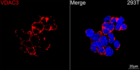 VDAC3 Antibody in Immunocytochemistry (ICC/IF)