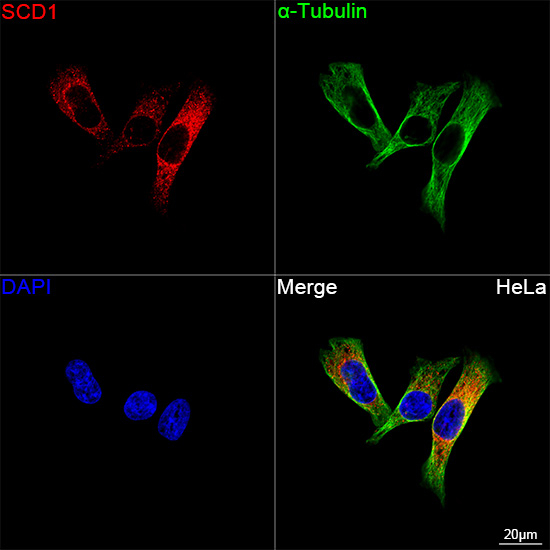 SCD Antibody in Immunocytochemistry (ICC/IF)