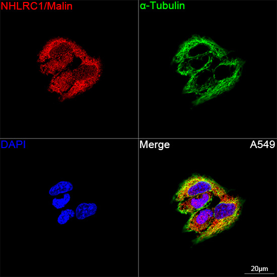 NHLRC1 Antibody in Immunocytochemistry (ICC/IF)