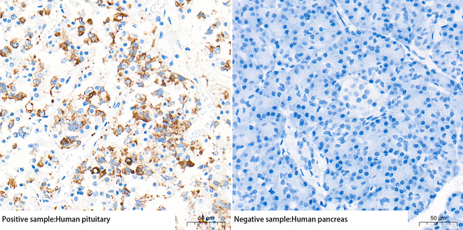 Prolactin Antibody in Immunohistochemistry (Paraffin) (IHC (P))