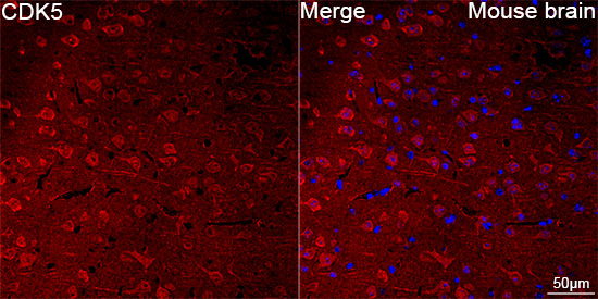 CDK5 Antibody in Immunohistochemistry (Paraffin) (IHC (P))