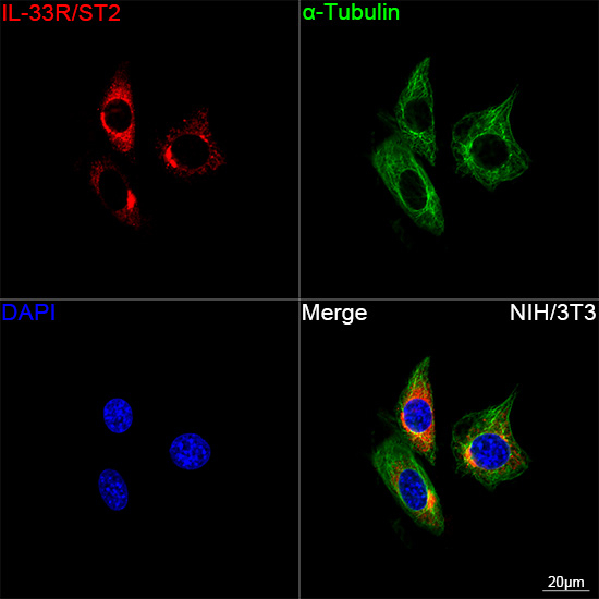 ST2 Antibody in Immunocytochemistry (ICC/IF)