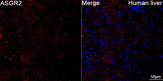 ASGR2 Antibody in Immunohistochemistry (Paraffin) (IHC (P))